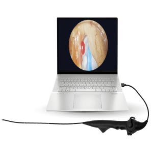 Video Fleksible Nazofaringoskop